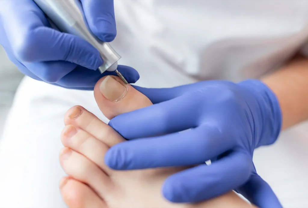 Foot Master Clinic - Podiatry Clinic Towcester - 06